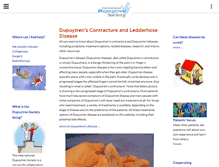 Tablet Screenshot of dupuytren-online.info